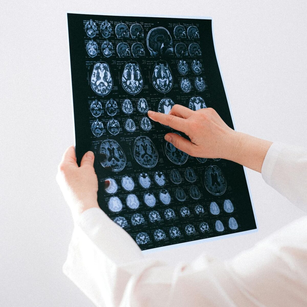 Diagnóstico Médico 2.0: Como a Inteligência Artificial Revoluciona a Saúde — como a inteligência artificial está mudando o di